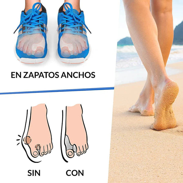 Corrector de Juanetes Efectivo