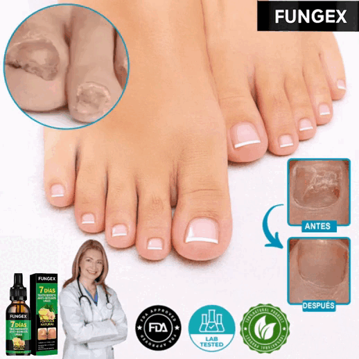 Fungex™ | Elimina los Hongos en las Uñas y Restaura Uñas Sanas en un 95% en Solo 7 Días