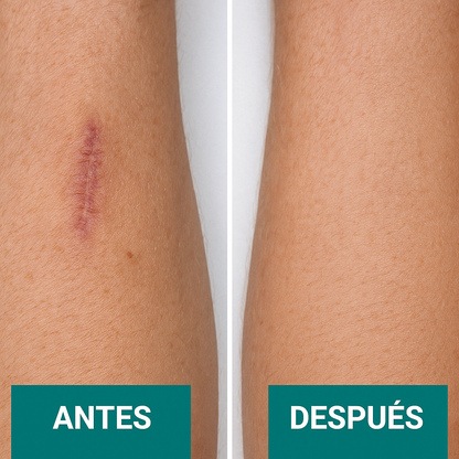 CicatriLess
